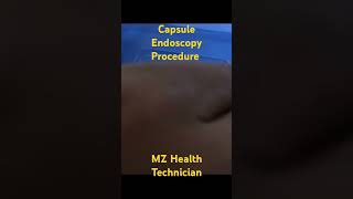 Capsule Endoscopy Procedure [upl. by Crespi594]