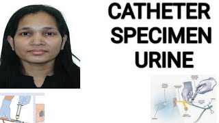 Catheter specimen urine NMC OSCECatheter specimen collection [upl. by Sirrap]