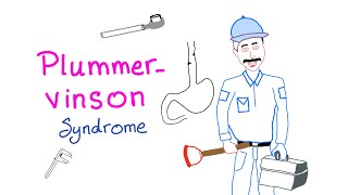 PlummerVinson Syndrome [upl. by Ahsienar687]