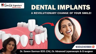 আপনার হাসি কি আগের মতো নেই Dental implants  স্বল্পখরচে ফিরে আসুক সেই নিখুঁত হাসি [upl. by Onidranreb]