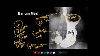 Radiological anatomy of Abdomen [upl. by Ellenhoj479]