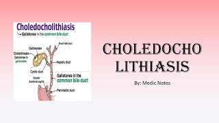 Choledocholithiasis  definition signs and symptoms investigation treatment [upl. by Niawat]