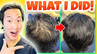 How I Treated My Thinning Hair the Holistic Way [upl. by Yrehc173]