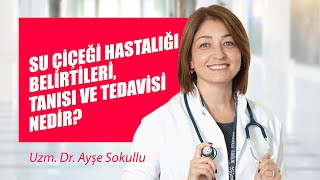 Su çiçeği hastalığı belirtileri tanısı ve tedavisi nedir [upl. by Gusba]