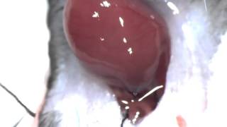 Hetrotopic Heart Transplant [upl. by Innus247]