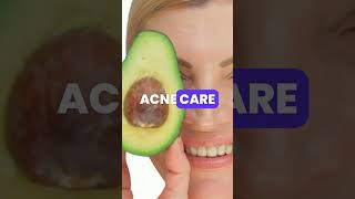 3 incredible health benefits of AVOCADO [upl. by Acassej269]