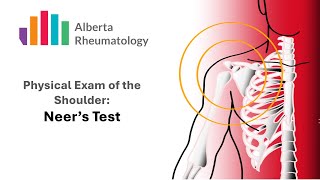 Neers Test Rheumatology Shoulder Physical Exam Special Tests [upl. by Tim]