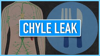 Chyle Leak  Emphasis on DietNutrition [upl. by Menides]