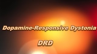 Dopamineresponsive dystonia [upl. by Welton]