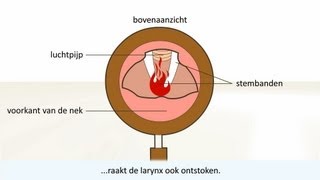 Keelontsteking  de oorzaak en behandeling [upl. by Gerkman327]