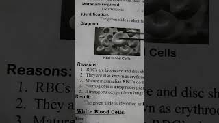 red blood cells and white blood cells [upl. by Adym]