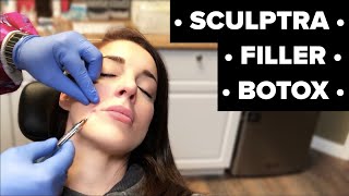 Getting Sculptra Filler amp Botox [upl. by Hardden]