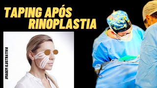 Taping apos rinoplastia [upl. by Hewet]