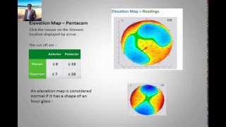 Simple Guide to Corneal Topography amp Pentacam  follow for more at quickguideorg [upl. by Danella]