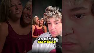 Gêmeas siamesas 😱🤣 livedobrino humor [upl. by Noswal]