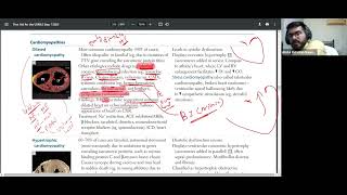 CVS PATHO PART3 CARDIOMYOPATHIES FIRST AID USMLE STEP1 URDUHINDI [upl. by Nils]