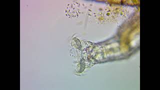 Rotifers Head and Cilia  Close View Under a Microscope [upl. by Secnarfyram]