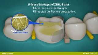 everStick XENIUS base instructions for use [upl. by Moreta812]