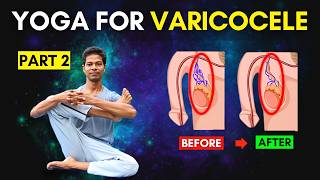 Varicocele Exercises Part 2 Follow Along At Home  Yoga for Varicocele varicocele [upl. by Glarum521]