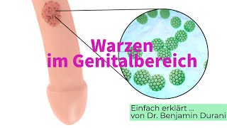 Warzen im Genitalbereich  Ursache amp Behandlung  Einfach erklärt von Dr Durani [upl. by Anaujit822]