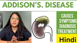 Addison’s Disease  Explained in Hindi  Causes Signs amp Symptoms Diagnosis amp Treatment  Notes [upl. by Kurt351]