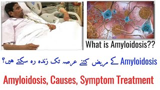 Amyloidosis Causes Symptoms amp Treatment Musharafillness PakCourt [upl. by Pastelki292]