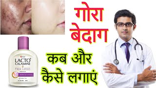 Lacto Calamine face lotion HONEST Review 2023 in hindi  Results Benefits Uses Price Info [upl. by Kenaz]