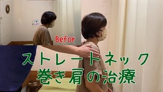 【巻き肩・ストレートネック】 肩・首の痛み 姿勢から根本改善 治療の様子 猫背 スマホ首 50肩 [upl. by Ttenaj]