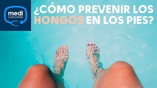 ¿Cómo puedo prevenir los hongos en los pies MediConsultas [upl. by Htomit]