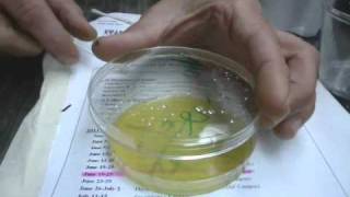 Petri Dish1  Plating Bacteriawmv [upl. by Wagner]