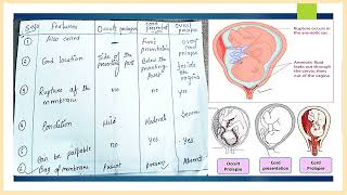 obstetrical emergency cord prolapse NGMedicals [upl. by Navoj]