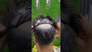 Avoid These Common Mistakes When Clipping Hair Patches shorts hairpatch hairtransformation [upl. by Nani]