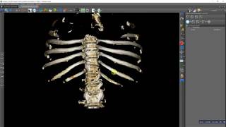 Manual 3D rib cage bones segmentation [upl. by Critta339]