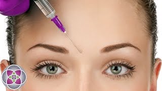 What is Botox  Botox Before and After Treatment [upl. by Whittaker]