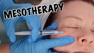 Mesotherapy Facial  Anti Aging Treatment [upl. by Thetos329]