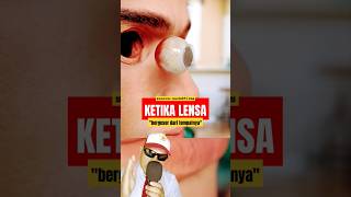 KETIKA SOFTLENS Keluar dari tempatnya education sains physics science zackdfilms eyes [upl. by Waite]