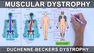 Muscular Dystrophy  Types and Mutations [upl. by Rosabella]