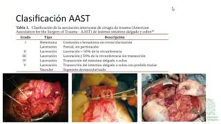 Anastomosis diferida de colon en trauma  Dr Alejandro Gutiérrez [upl. by Anialeh]