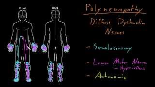 Syndrome Polyneuropathy [upl. by Sulokcin]