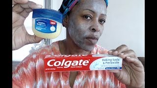 COLGATE BAKING SODA PEROXIDE TOOTHPASTE VASELINE FACE NECK DARK SPOT HYPER PIGMENTATION REMOVAL [upl. by Charlena]