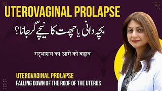 Bacha Dani Ya Chatt Ka Niche Gir Jana  Uterovaginal Prolapse in UrduHindi [upl. by Marina]