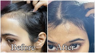 Best Hair Serums For Reduced Hair fall and Hair Growth [upl. by Adnhoj272]