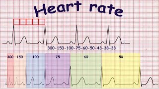 ECG basics Methods of heart rate calculation [upl. by Eriuqs]