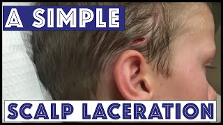 A Sunday Scalp Laceration [upl. by Negrom]