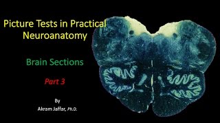 Picture Test in Neuroanatomy Brain Sections 3 [upl. by Ereveniug]