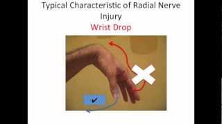 Radial Nerve Test [upl. by Abrams140]