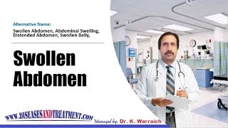 Swollen Abdomen Abdominal Swelling  Causes Diagnosis Symptoms Treatment Prognosis [upl. by Yruy]