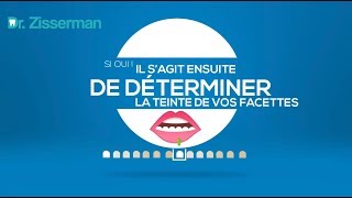 Les facettes dentaires en 1 minute [upl. by Eelik464]