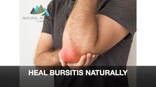 Heal Bursitis Naturally [upl. by Mohl]