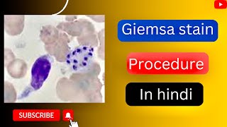 Giemsa stain procedure in hindi l giemsa stain kese karte hai l Giemsa stain for bone merrow l [upl. by Innej]